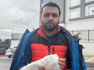 Ankara'da köpeklerin saldırısından kaçarken düştü: Kolunu kırdı