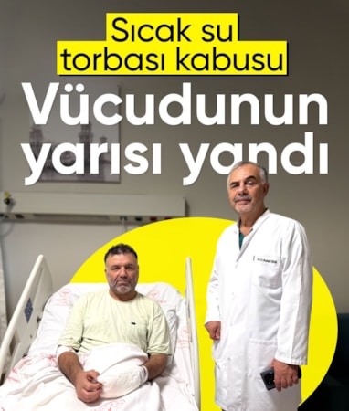 İstanbul'da sıcak su torbası patlamasıyla vücudunun yüzde 30'u yandı