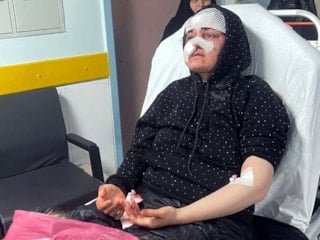 Gaziantep'te boşanma aşamasındaki karısını kaldırım taşıyla dövdü