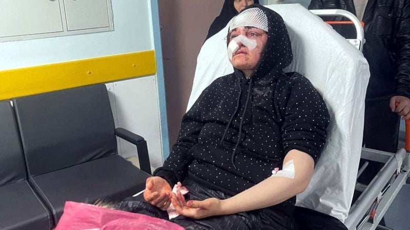 Gaziantep'te boşanma aşamasındaki karısını kaldırım taşıyla dövdü