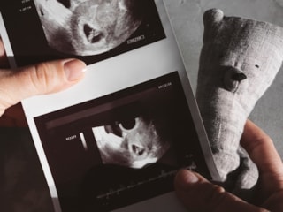 Kese görüntüsüne göre cinsiyet tahmini