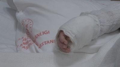 İstanbul'da bebeğin üzerine kaynar su döküldü: Vücudunun yüzde 27'si yandı