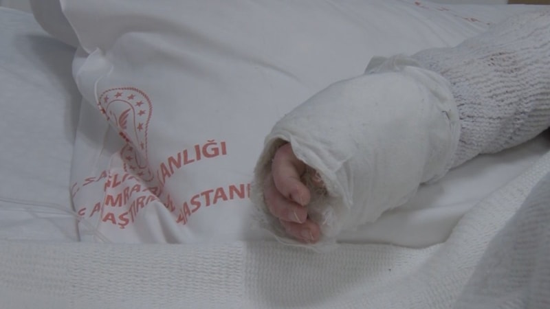 İstanbul'da bebeğin üzerine kaynar su döküldü: Vücudunun yüzde 27'si yandı