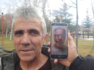 Kayseri’de Epstein'e benzetildiği için görünümünü değiştirdi