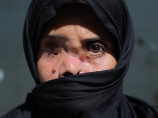 Gazze'de öldü sanılıp kefenlendikten sonra hayatta olduğu tespit edildi