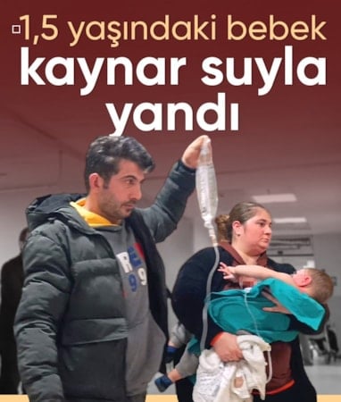 Bursa'da 1,5 yaşındaki bebeğin üzerine kaynar su döküldü