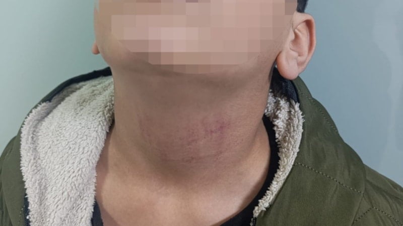 İstanbul'da kadın memur 10 yaşındaki öğrenciyi okulda darbetti