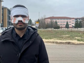 Eskişehir'de rehber öğretmeni, fizik öğretmeninin yüzüne sıcak çay fırlattı