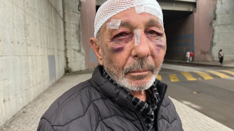 Kocaeli'de çakmak istedikten sonra darbettiler