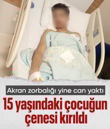 Antalya'da akran zorbalığına uğrayan çocuğun çenesi kırıldı
