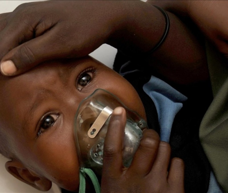 Nijerya'da Lassa ateşi nedeniyle can kaybı 70'e yükseldi