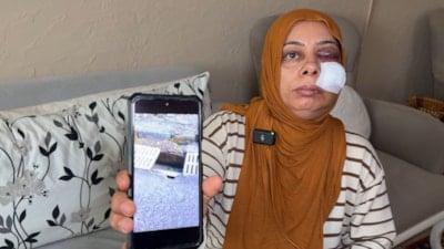 Hatay'da elektrikli bisikletten düşen kadının yüzüne 14 dikiş atıldı