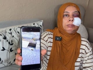 Hatay'da elektrikli bisikletten düşen kadının yüzüne 14 dikiş atıldı