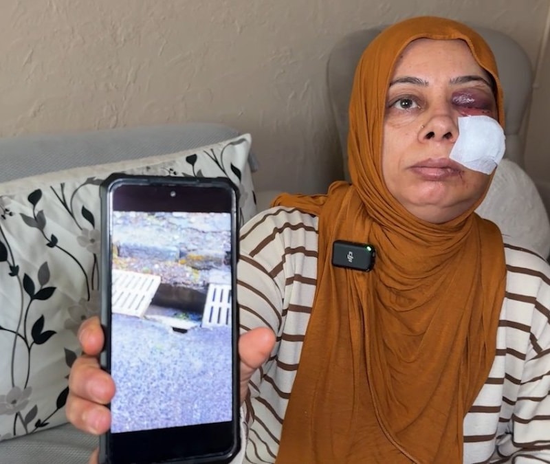 Hatay'da elektrikli bisikletten düşen kadının yüzüne 14 dikiş atıldı