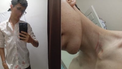 İstanbul'da 16 yaşındaki çocuğu "taciz" iddiasıyla darbettiler