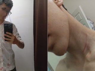 İstanbul'da 16 yaşındaki çocuğu "taciz" iddiasıyla darbettiler