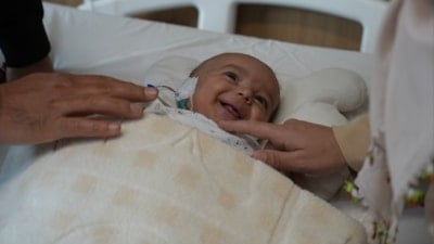 Gaziantep’te nadiren görülen tümör, Talha bebekten başarıyla alındı