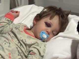 Yalova'da baba ve kızını darbeden şüpheli: Kucağındaki çocuğu fark etmemişim