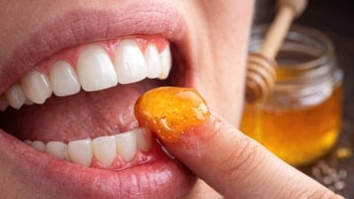 Doğal ilacı çıktı! Diş etlerine bal sürmek dişçiden kurtarıyor...