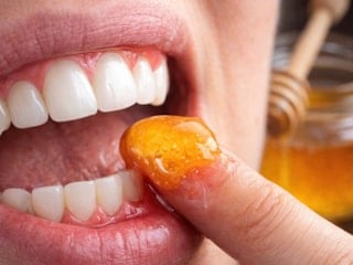 Doğal ilacı çıktı! Diş etlerine bal sürmek dişçiden kurtarıyor...