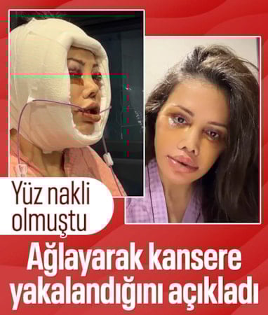 Didem Ceran kansere yakalandı