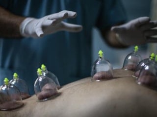 Oruçluyken hacamat yaptırılır mı? Mart 2026 hacamat günleri