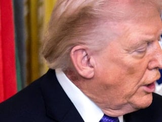 Trump'ın boynundaki leke gündem oldu: Beyaz Saray'dan açıklama geldi