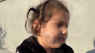 İzmir'de tasmasız köpek saldırısı: Küçük çocuk yüzünden ısırıldı