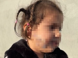 İzmir'de tasmasız köpek saldırısı: Küçük çocuk yüzünden ısırıldı