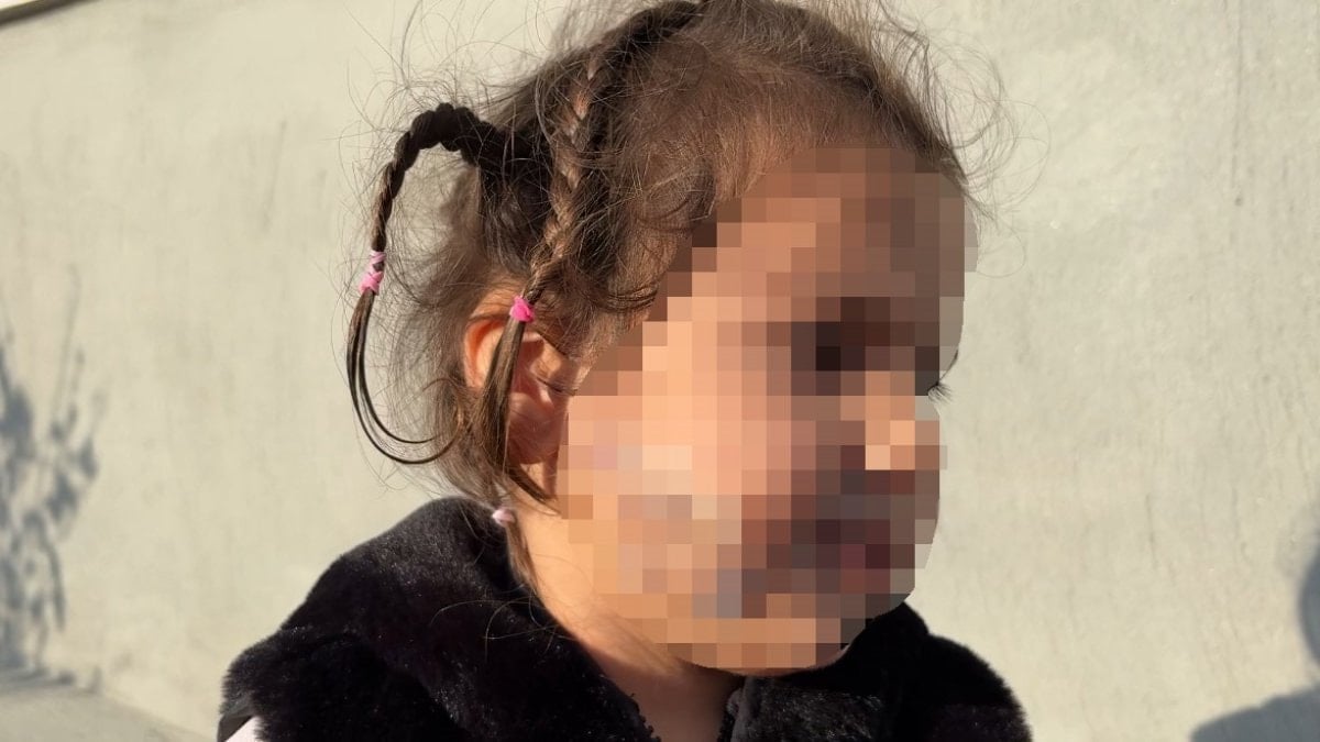 İzmir'de tasmasız köpek saldırısı: Küçük çocuk yüzünden ısırıldı