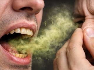 Nefesiniz kötü kokuyorsa dikkat: Oruç dışındaki 6 sebebi