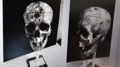 Zonguldak'ta barajda bulunan kemikler 18 yıllık cinayeti ortaya çıkardı