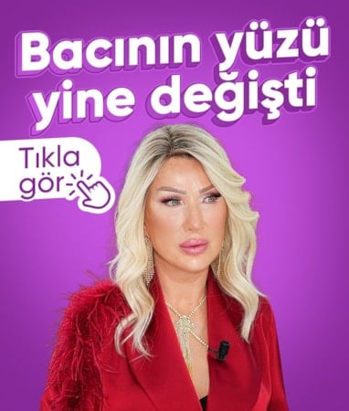Seda Sayan'ın yüzü yine değişti