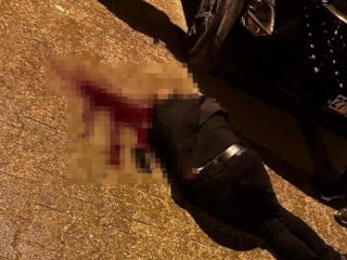 Şırnak'ta yürürken başından vuruldu