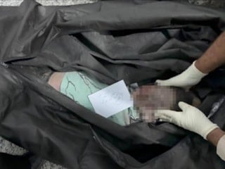 İran, ABD-İsrail saldırılarında en az 202 çocuğun öldüğünü açıkladı