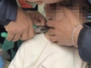 Adıyaman’da boynu plastik kelepçeyle sıkışan çocuk kurtarıldı