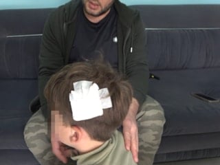 Yalova'daki komşu kavgasında bu kez 8 yaşındaki çocuğa taşlı saldırı