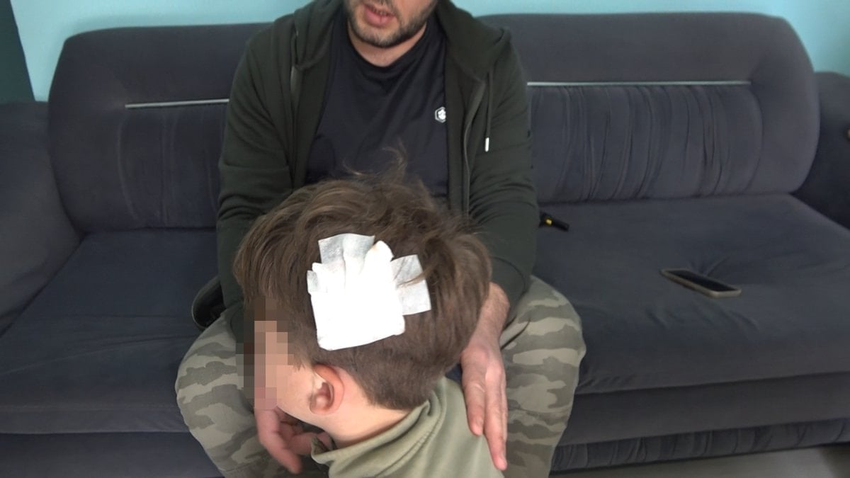 Yalova'daki komşu kavgasında bu kez 8 yaşındaki çocuğa taşlı saldırı