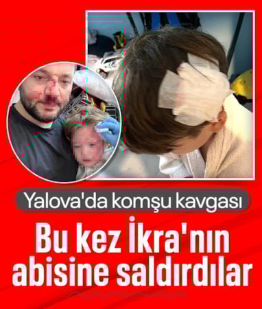 Yalova'daki komşu kavgasında bu kez 8 yaşındaki çocuğa taşlı saldırı