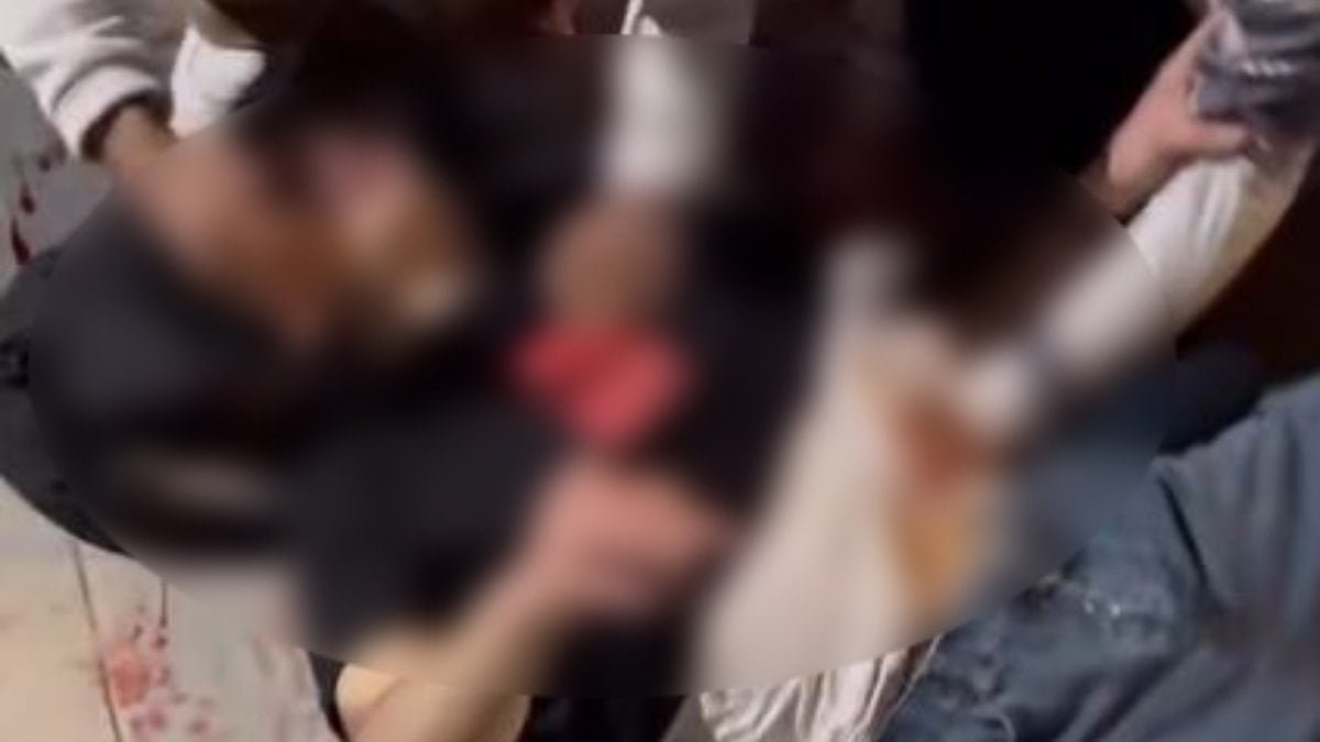 Ankara'da bıçaklı kavga: 2 yaralı