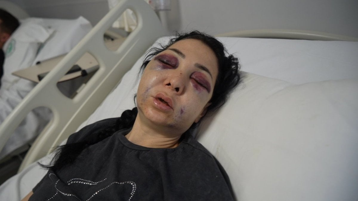 Kocaeli'de gittikleri kafede anne ve oğlu darbedildi