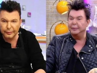 Yüzü deforme olmuştu! Kuşum Aydın'ın ameliyat oldu