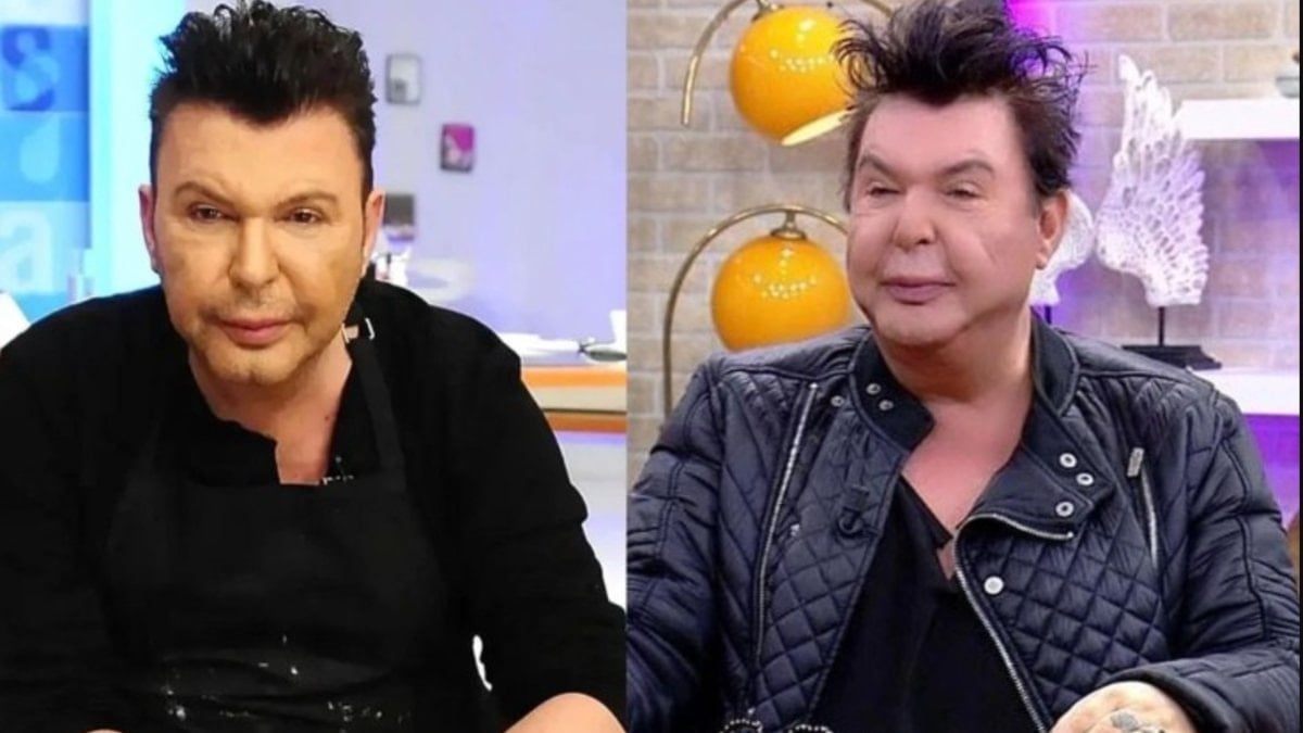 Yüzü deforme olmuştu! Kuşum Aydın'ın ameliyat oldu