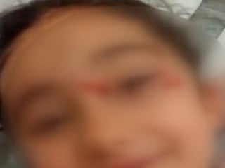 İstanbul'da 6 yaşındaki çocuğa köpekler saldırdı