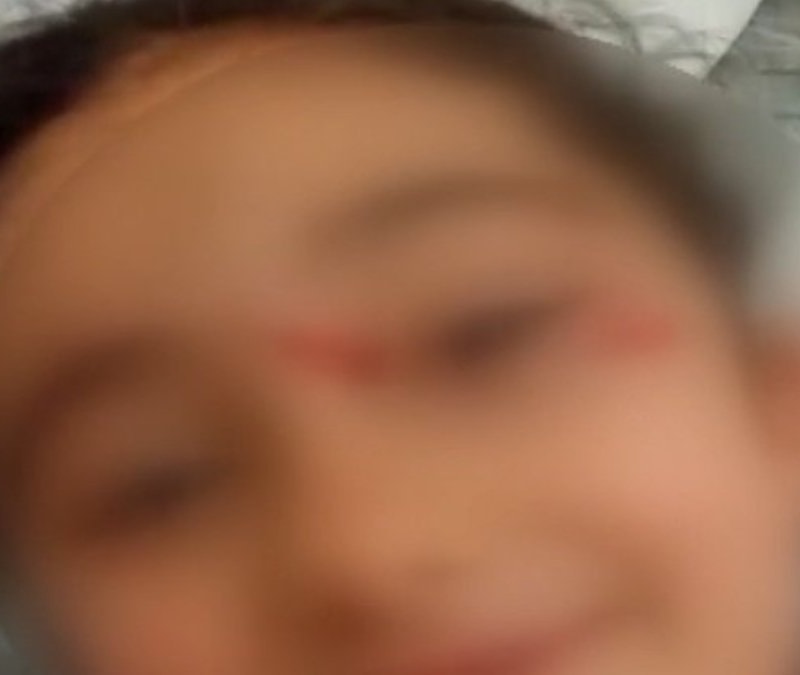 İstanbul'da 6 yaşındaki çocuğa köpekler saldırdı