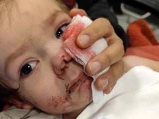 Ankara'da minik Efe'nin yaralandığı pitbull saldırısında istenen ceza belli oldu