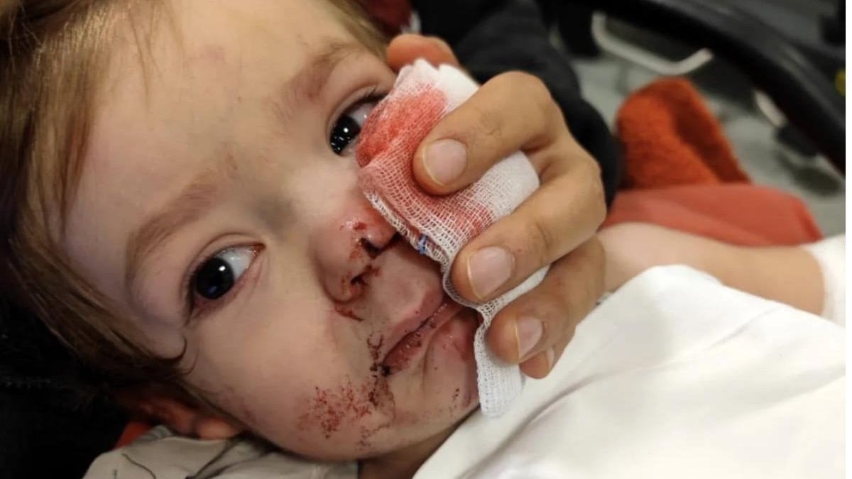 Ankara'da minik Efe'nin yaralandığı pitbull saldırısında istenen ceza belli oldu