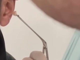 Kayseri’de şaşırtan yöntem: Uyuşturucuyu kulağında sakladı