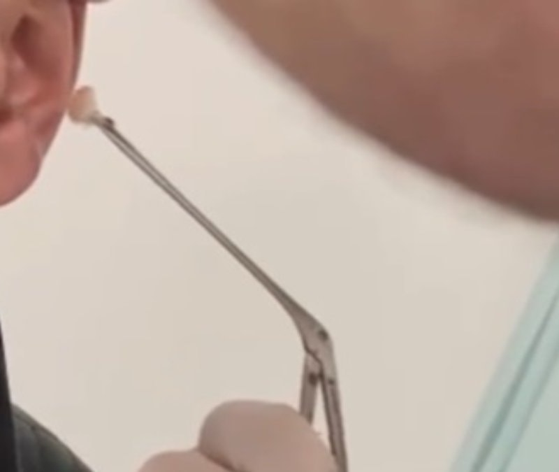 Kayseri’de şaşırtan yöntem: Uyuşturucuyu kulağında sakladı