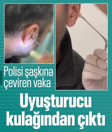 Kayseri’de şaşırtan yöntem: Uyuşturucuyu kulağında sakladı